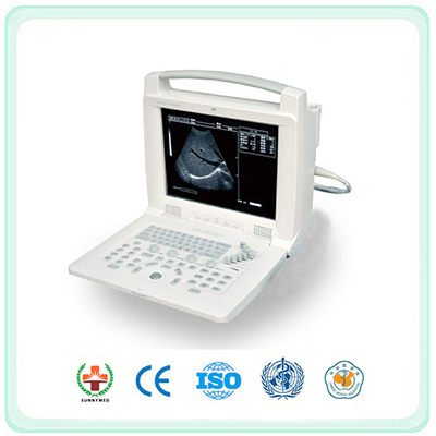 S3018I Digital Portable Ultrasound Scanner